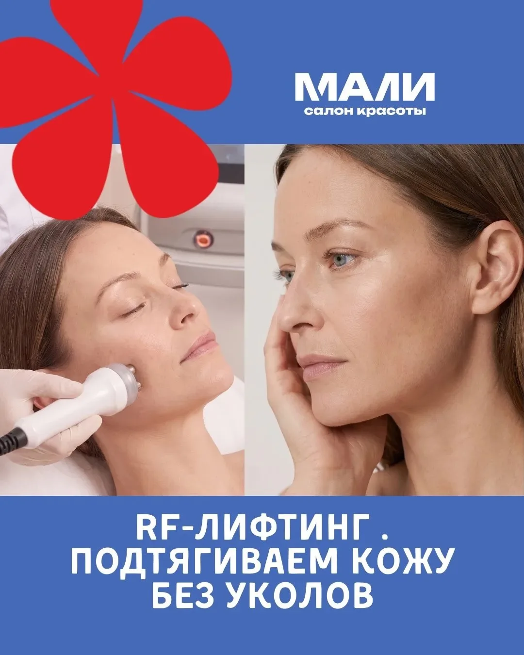 Новая процедура в Мали 🔥