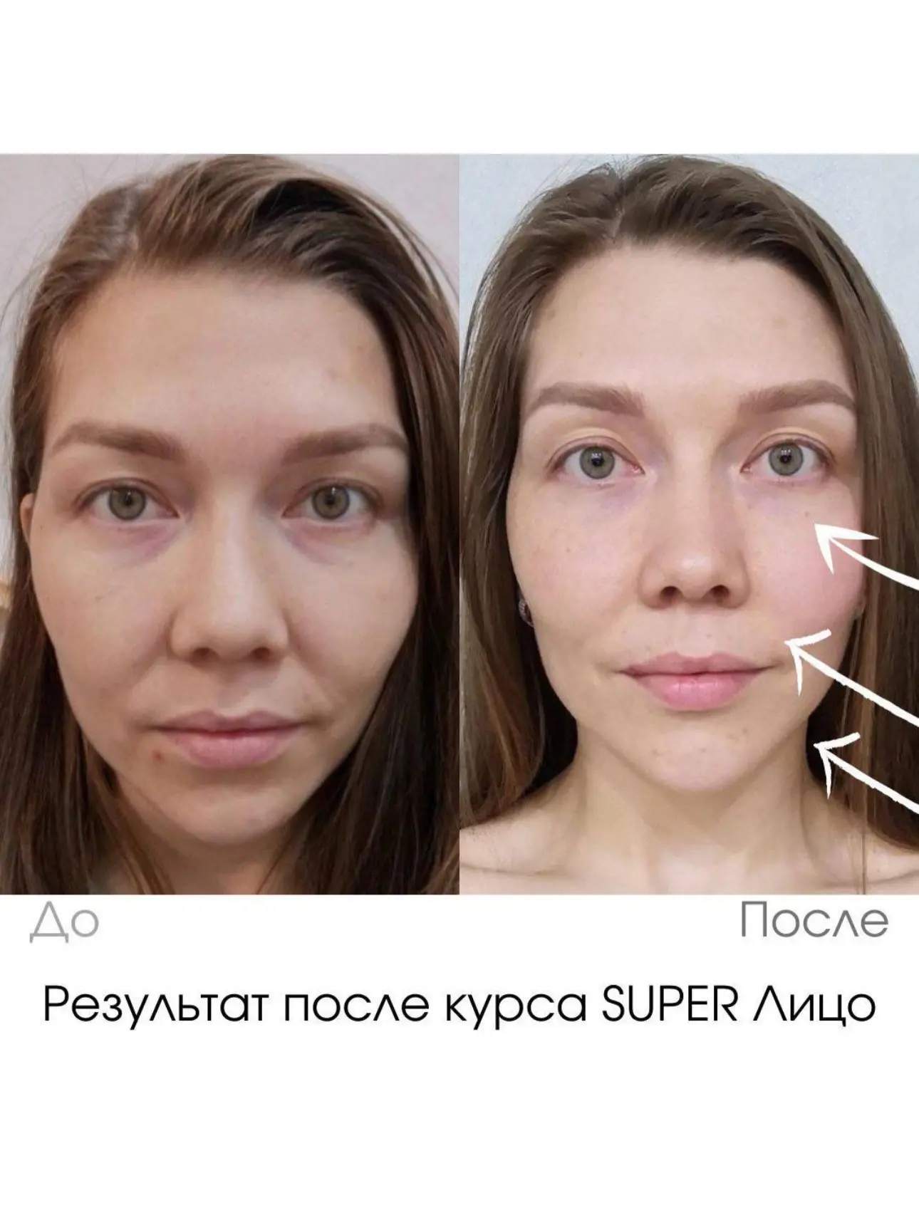 Обращали внимание, как с возрастом меняются пропорции лица?