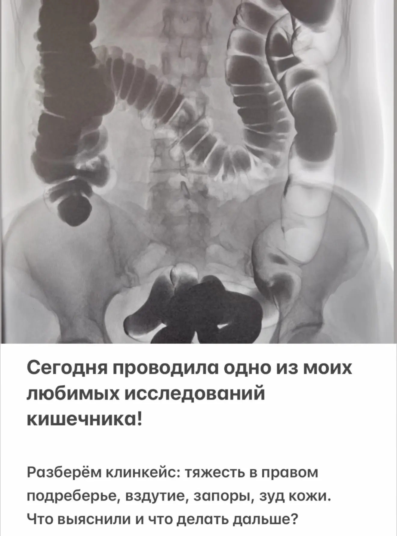 Я уже показывала этот снимок в сторис, вы оставили столько 🔥🔥🔥 под снимком, что без ...