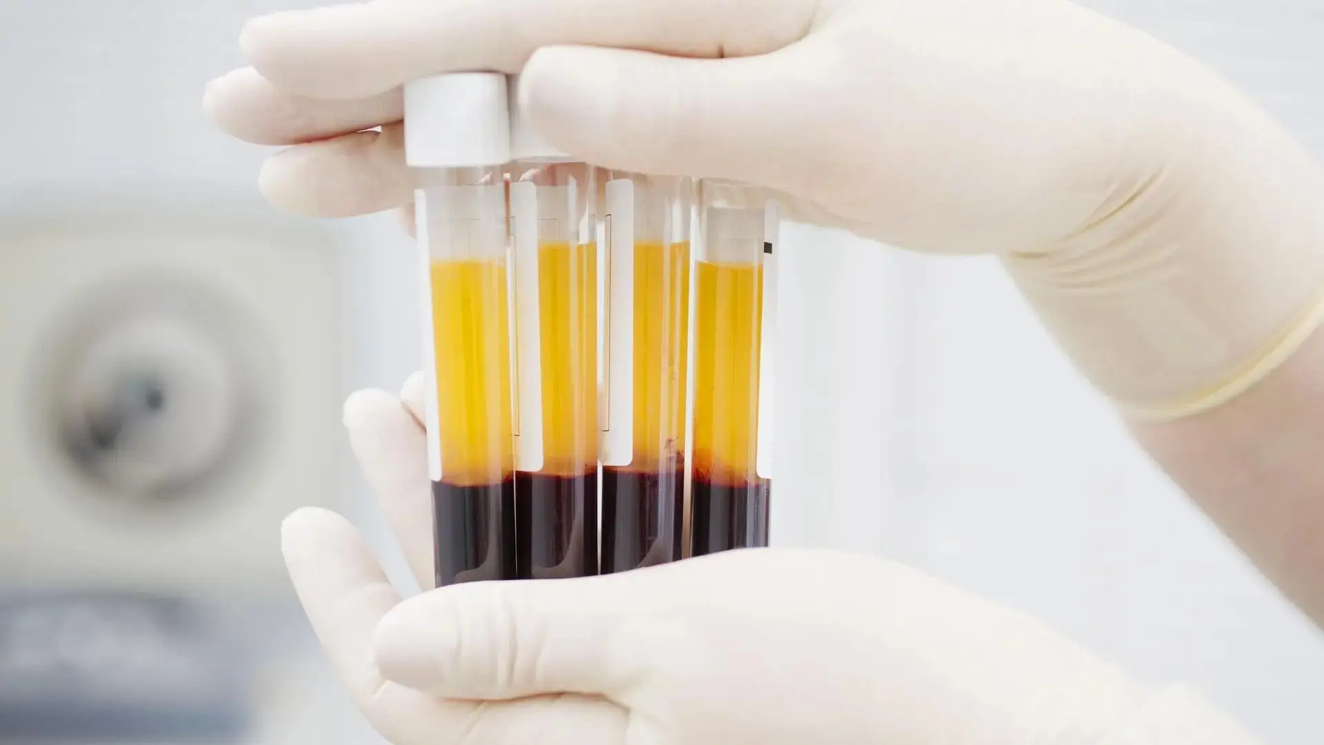 💉 Плазма: жизненно важный ресурс медицины!