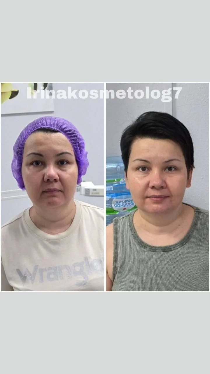 😔Утро начинается не с кофе, а с попыток вернуть лицу свежесть и чёткие контуры?