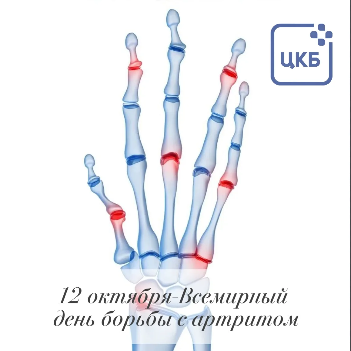 Знаете ли вы, что в мире от различных ревматических заболеваний страдает около 350 милл...