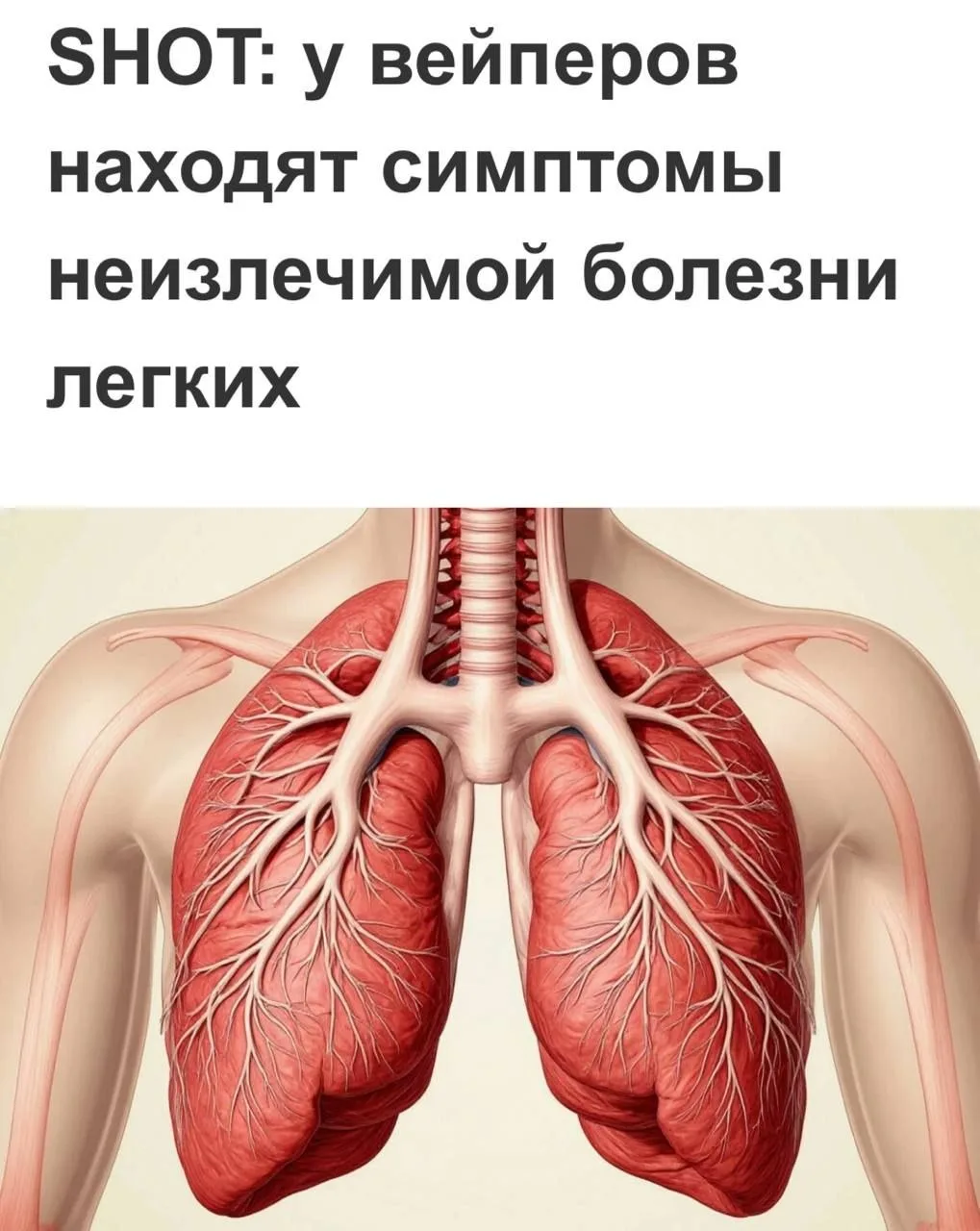 🫁 Смертельная неизлечимая болезнь лёгких ХОБЛ массово накрывает российских вейперов — ...
