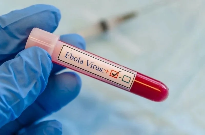 😷🦠 Онищенко допустил завоз Эболы в Россию