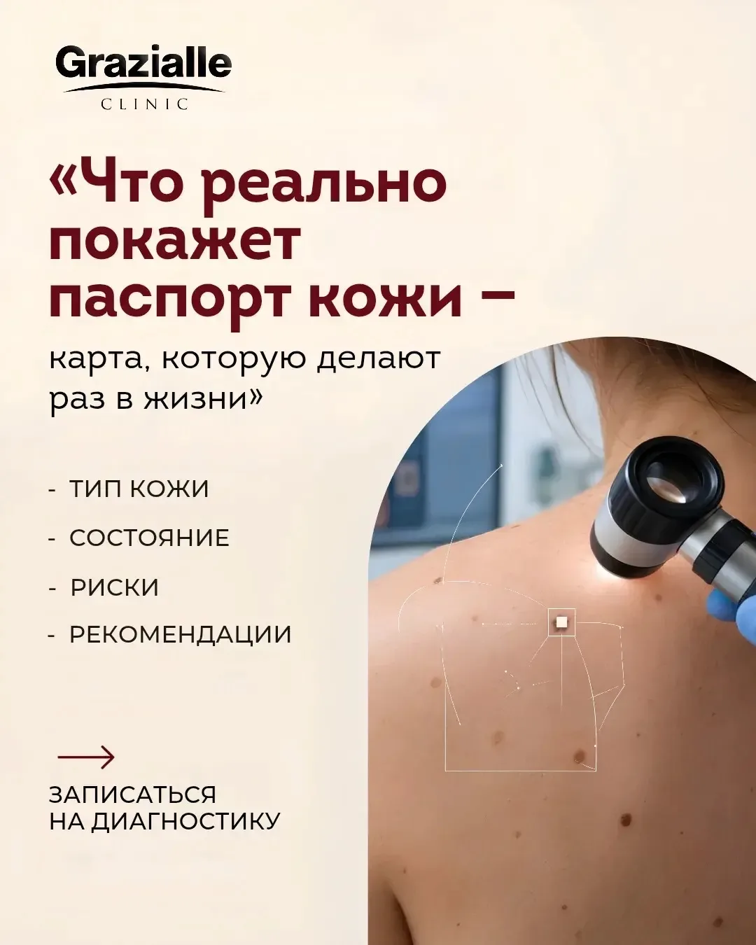 Родинка изменилась, а Вы и не заметили?