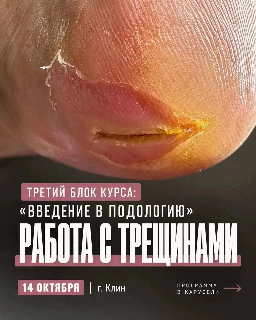 При работе с трещинами, (особенно с глубокими), у мастеров часто вопросов больше, чем о...