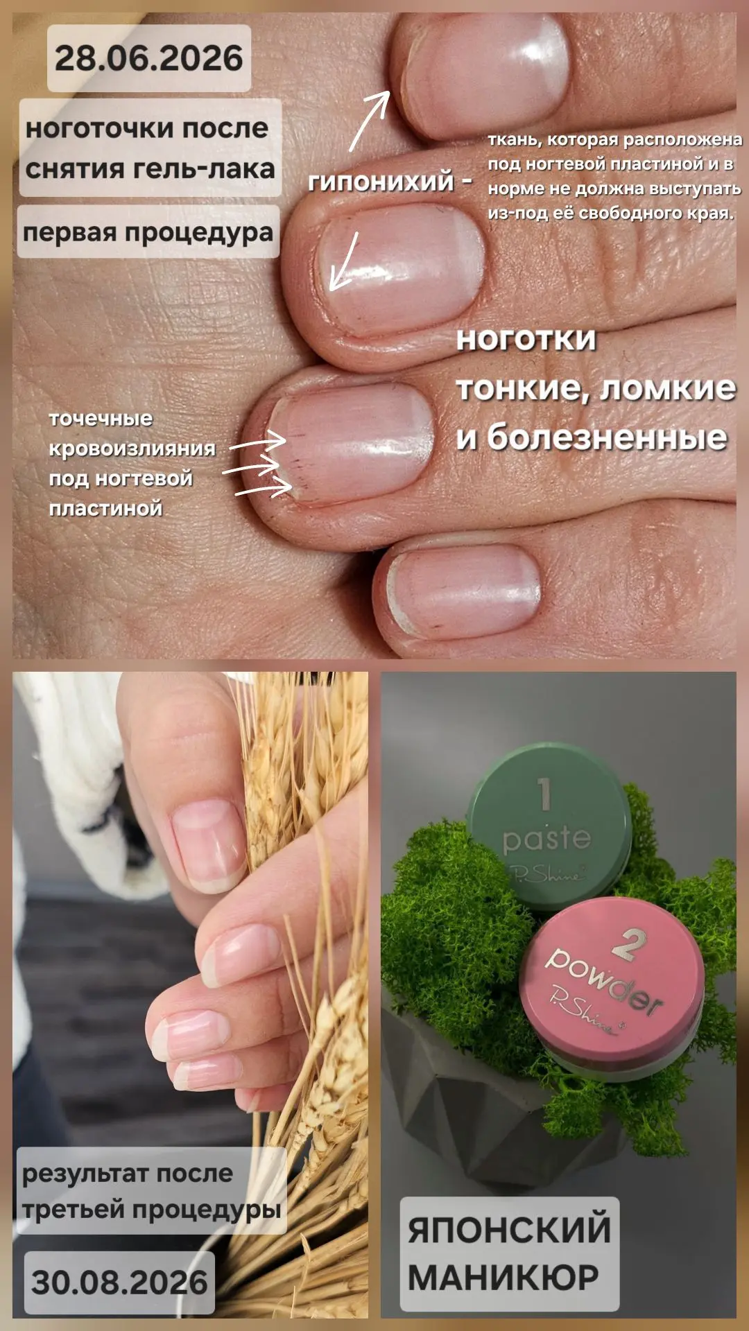 💅 Японский маникюр — это не разовая процедура, а курс!