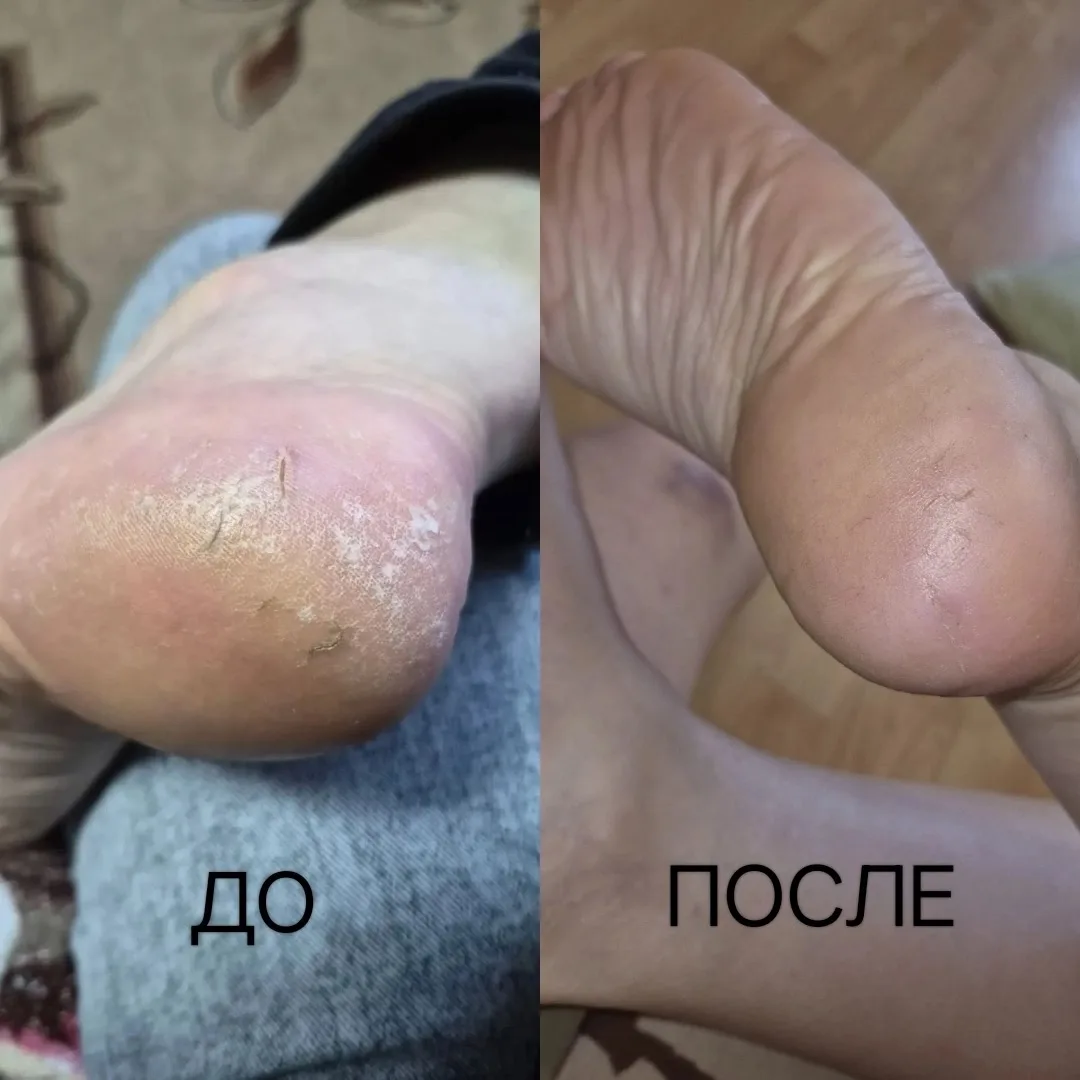 🔥Отзыв клиентки.