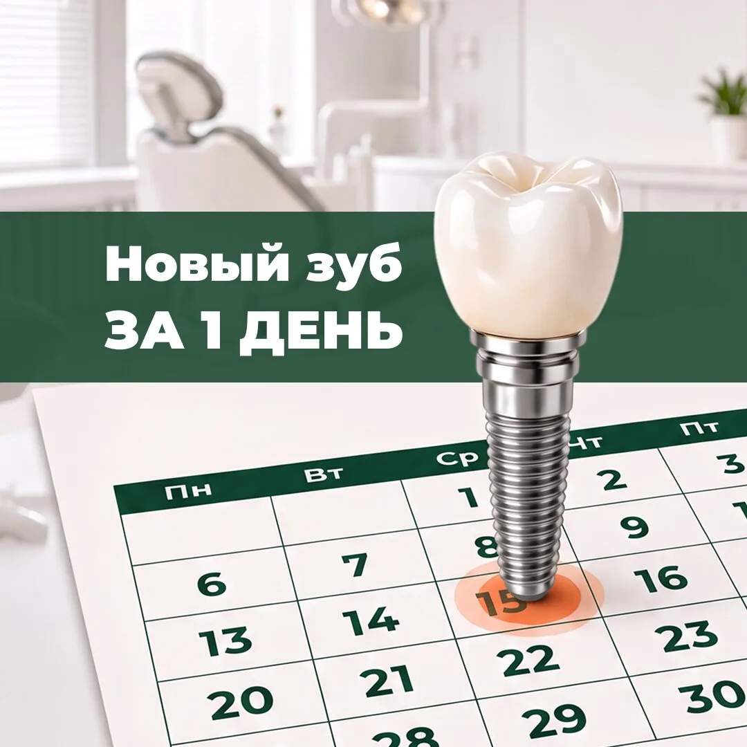 Имплантация зуба за 1 день в Сургуте. Рассрочка 0%!