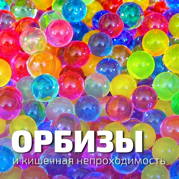 Страшнее арбузной косточки: орбизы