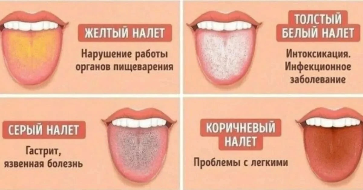 🧐 О ЧЕМ ГОВОРИТ ВАШ ЯЗЫК?