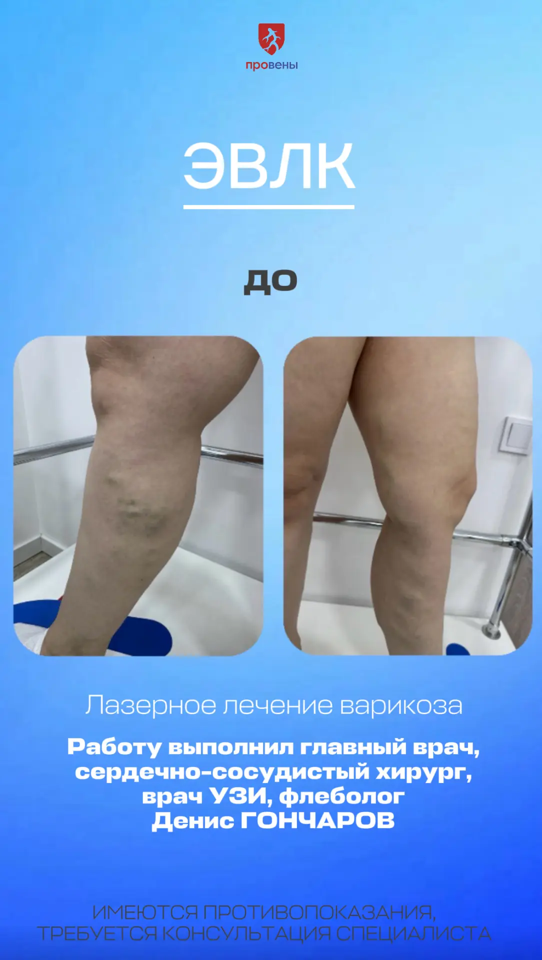 Самый лучший результат нашей работы – фото ДО и ПОСЛЕ лечения.