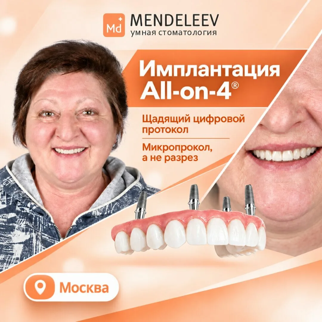 Имплантация всей челюсти за 1 день от 119.000 ₽ в Москве