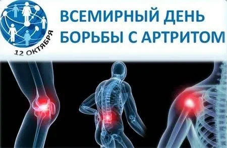 ✅Артрит - серьезный воспалительный процесс, поражающий один или несколько суставов. Отс...