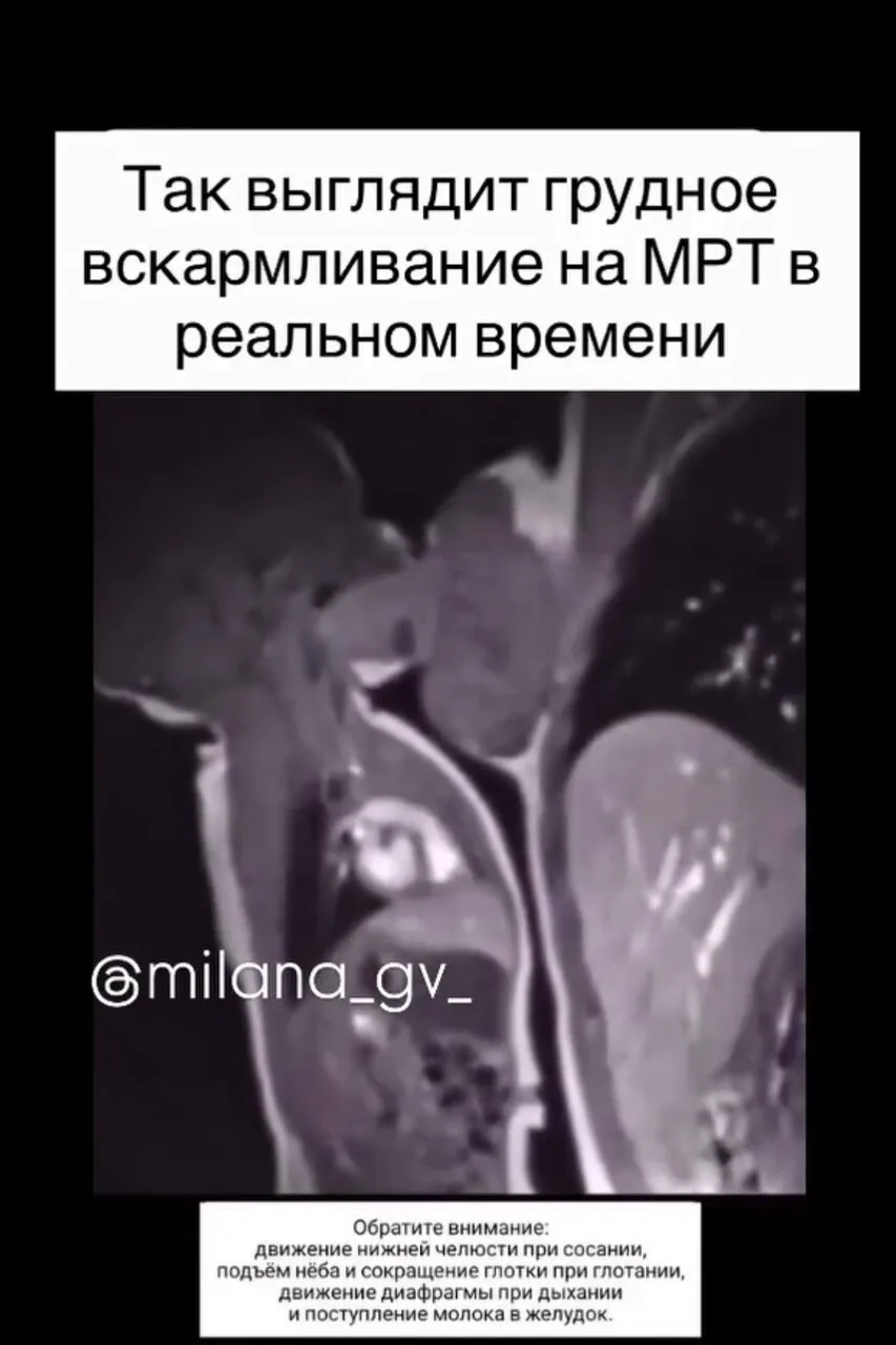 Вы когда-нибудь задумывались, что на самом деле происходит внутри, когда малыш находитс...