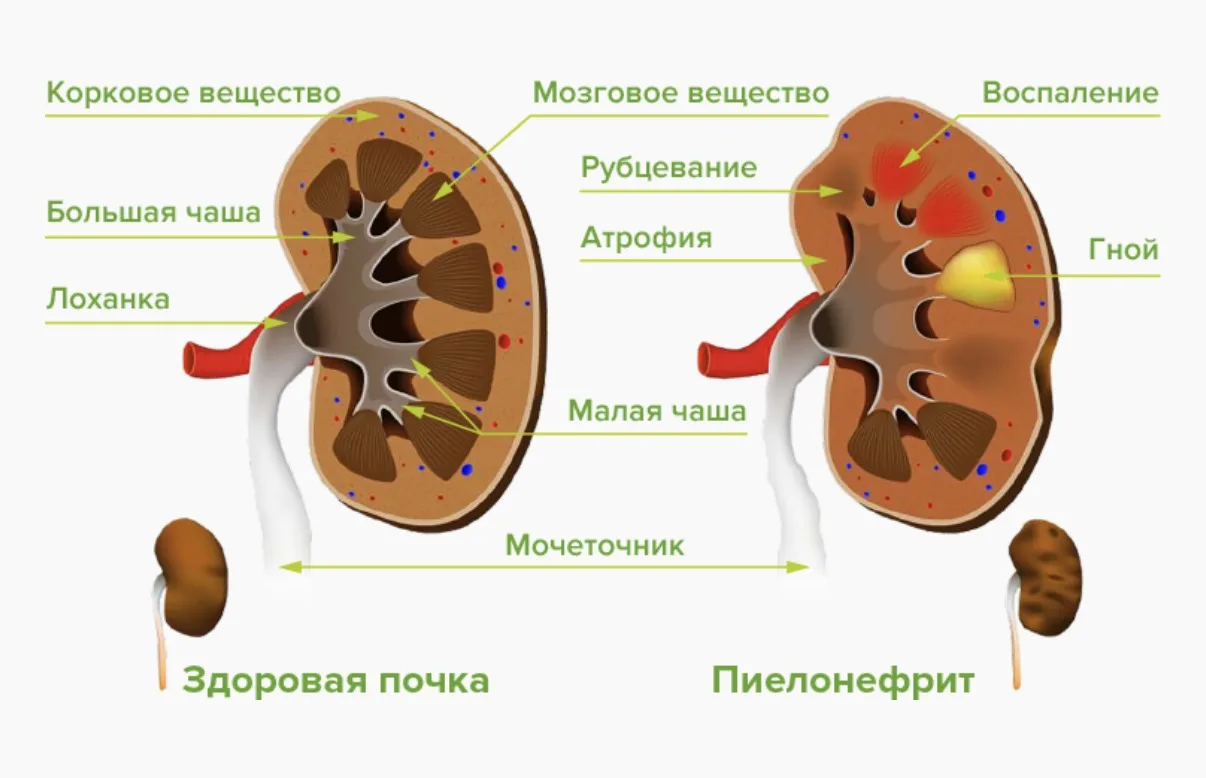 КАК ВОЗНИКАЕТ