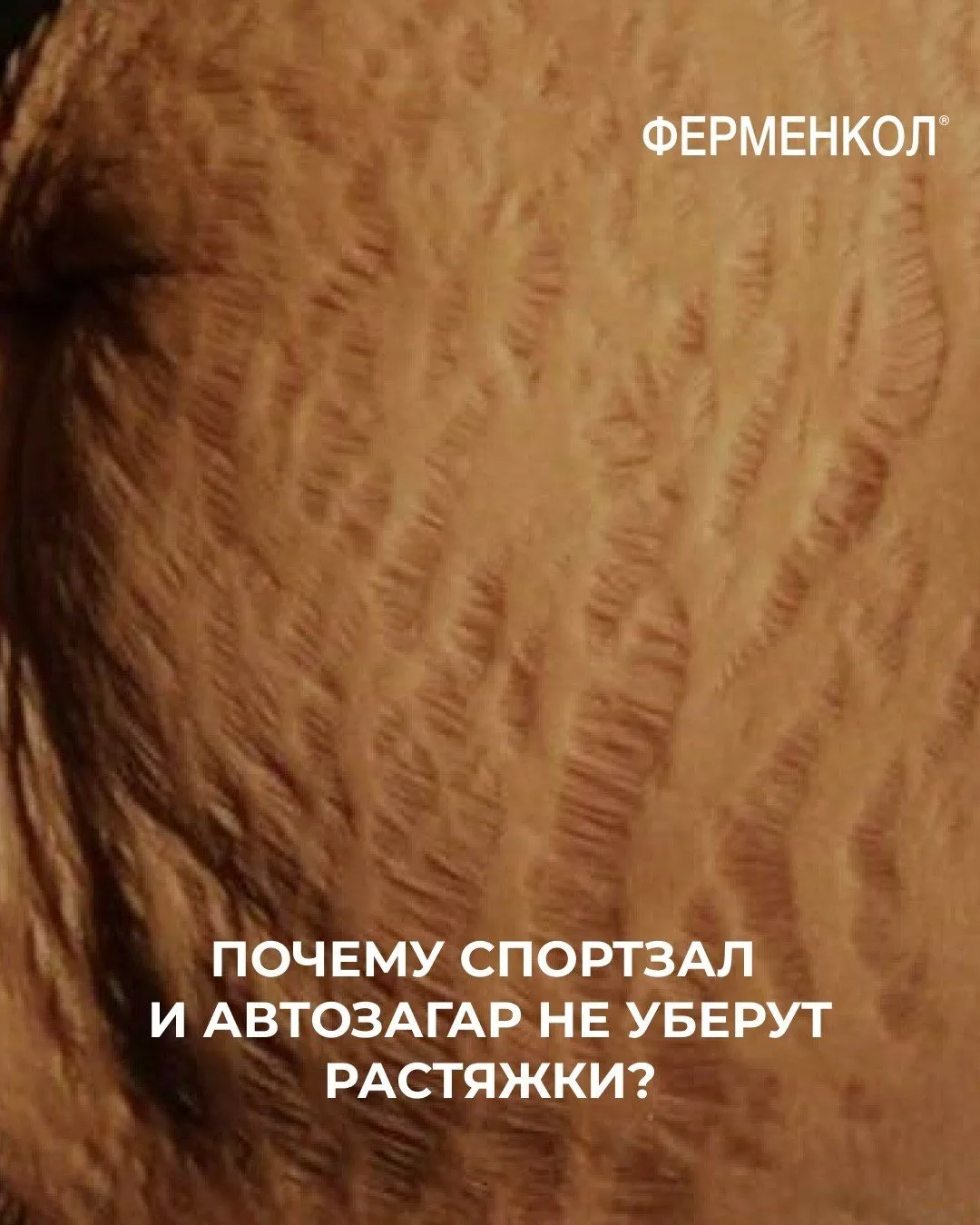 Шпаргалка по растяжкам!
