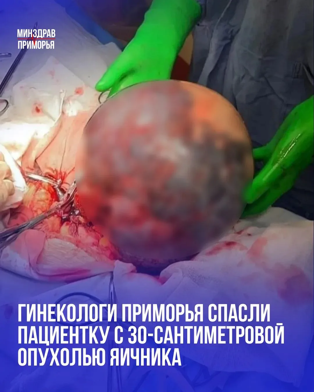 «Орган почернел, а придатки были на грани самоампутации»