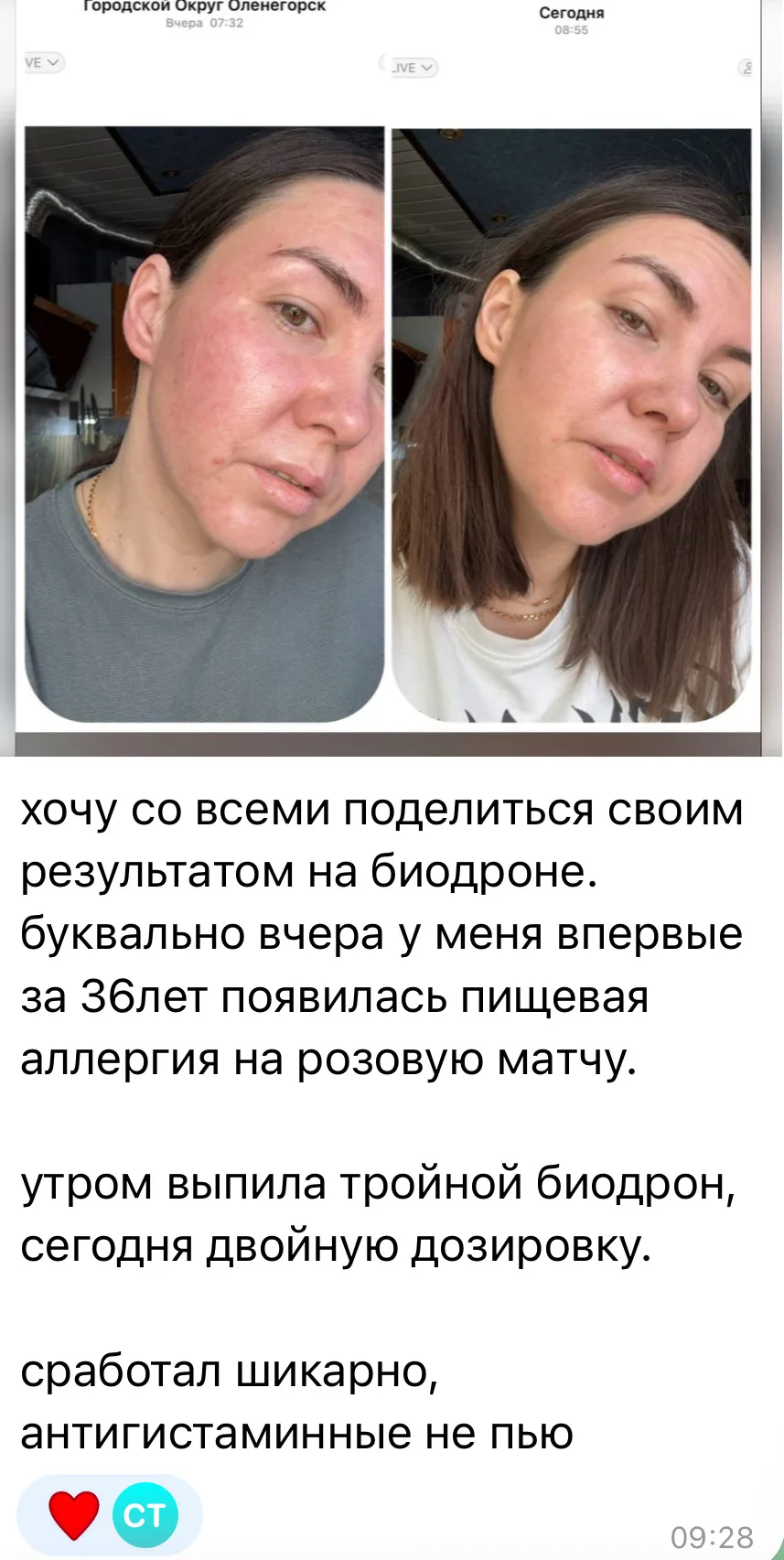 При аллергии ⬆️