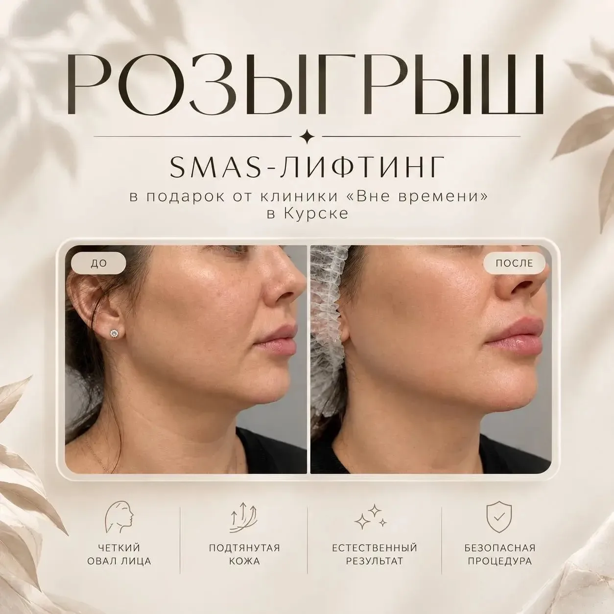Дарим SMAS-лифтинг одной из наших подписчиц 🌸