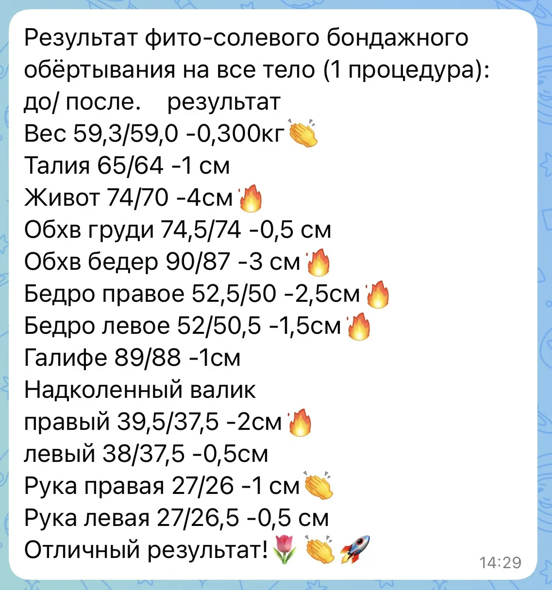 7 часов вчера летела во Вьетнам и знаете что? Ни малейшего отека после перелета!