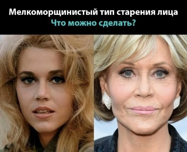 Мелкоморщинистый тип старения лица