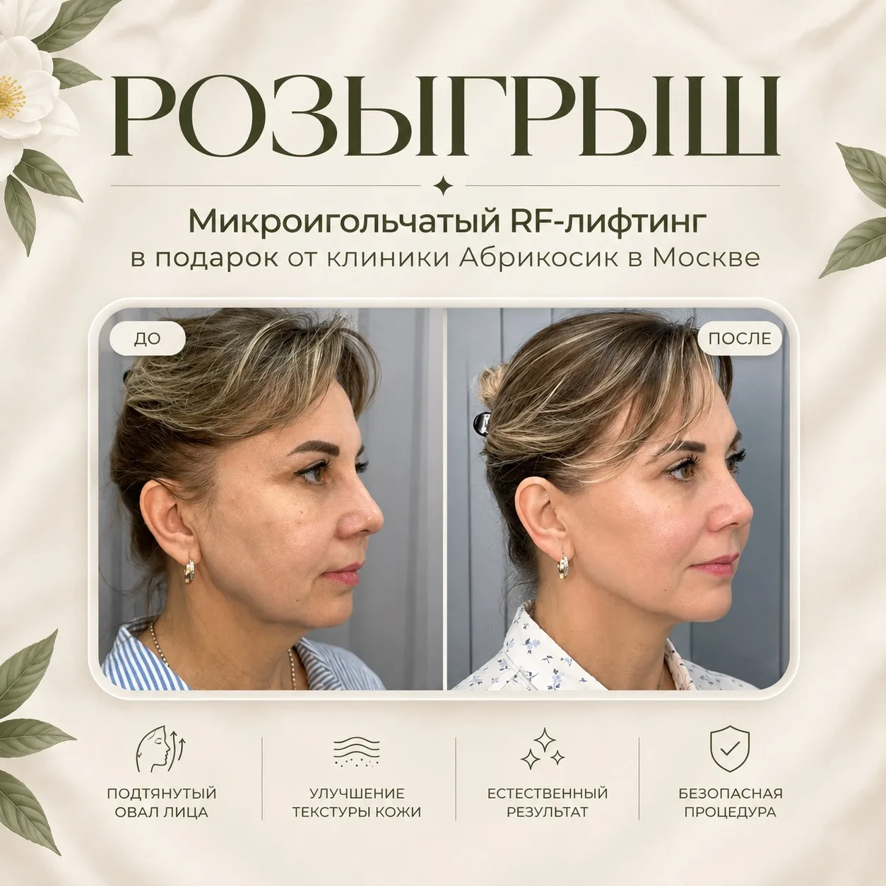 Москва, невероятный розыгрыш процедуры микроигольчатого RF-лифтинга! ❤️