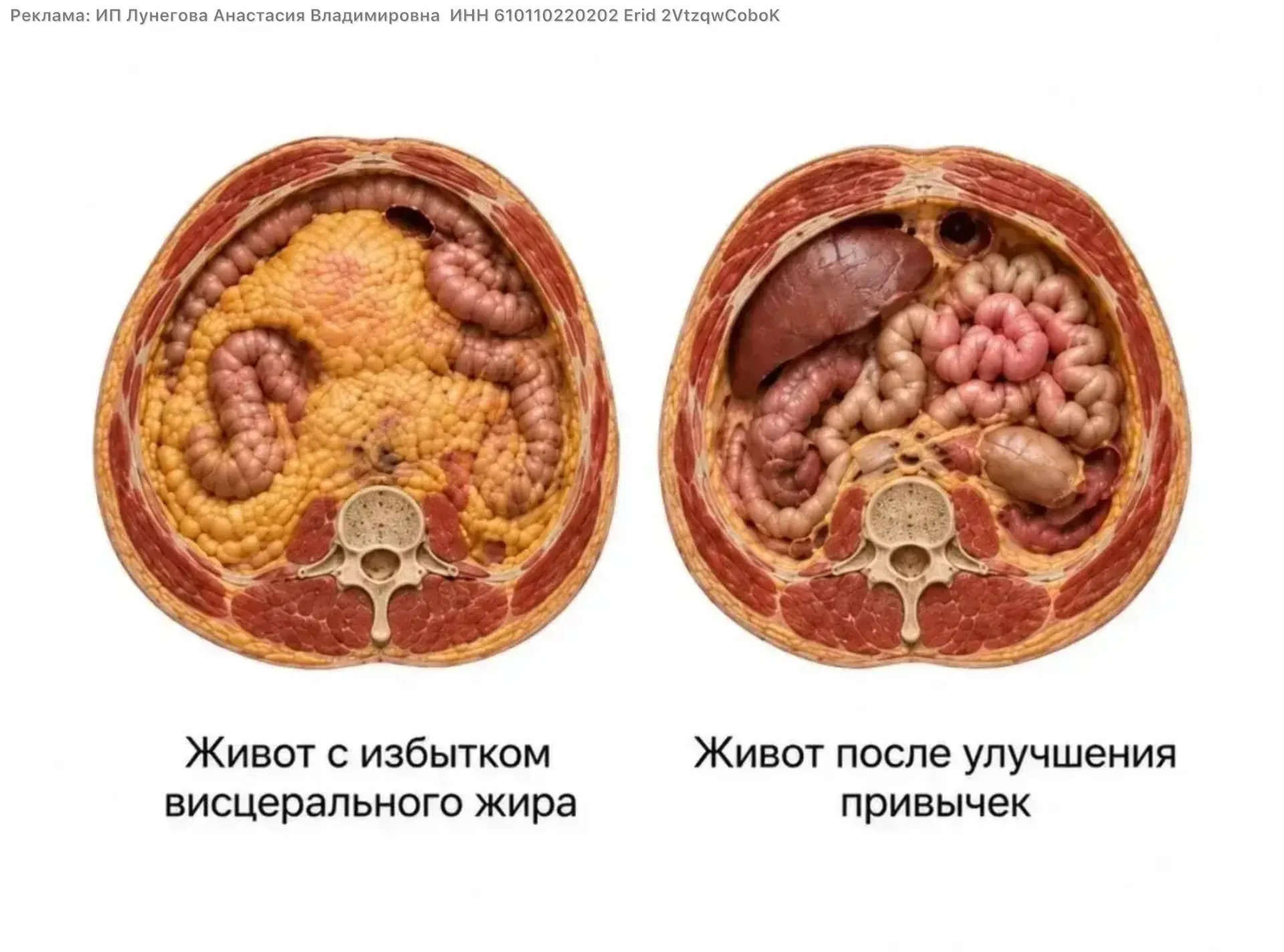 Девочки, а вы замечали, что иногда сколько ни качай пресс, живот всё равно остаётся вып...