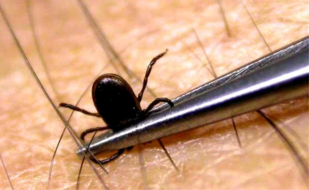 🕷️ Встреча с клещом: инструкция по выживанию для городских джунглей (без паники!)