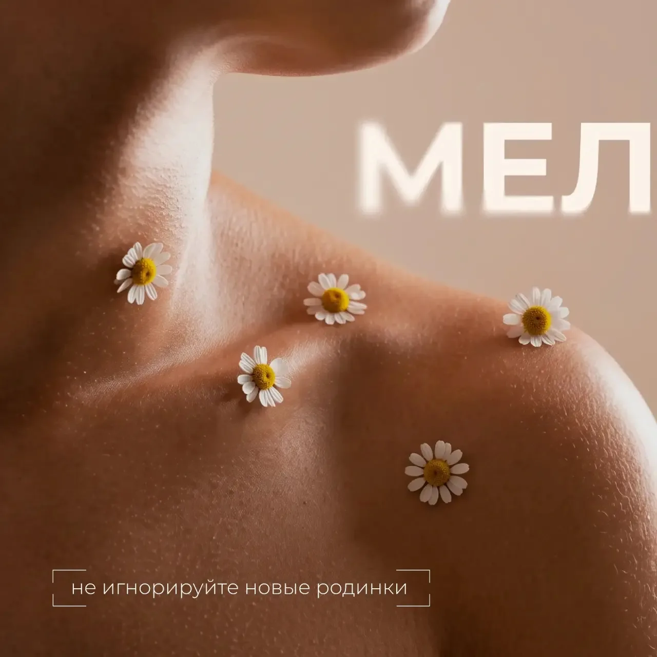 Что важно знать о меланоме❓