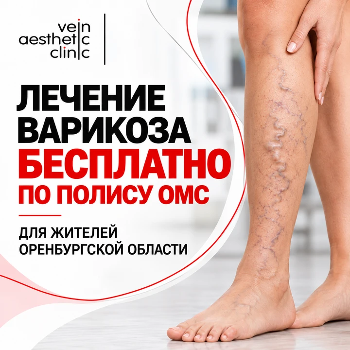 ❗Жителям Оренбурга и области доступно бесплатное лечение варикоза по полису ОМС.