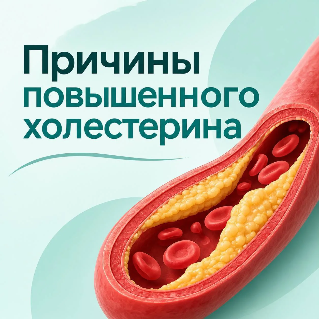 Причины повышенного холестерина.