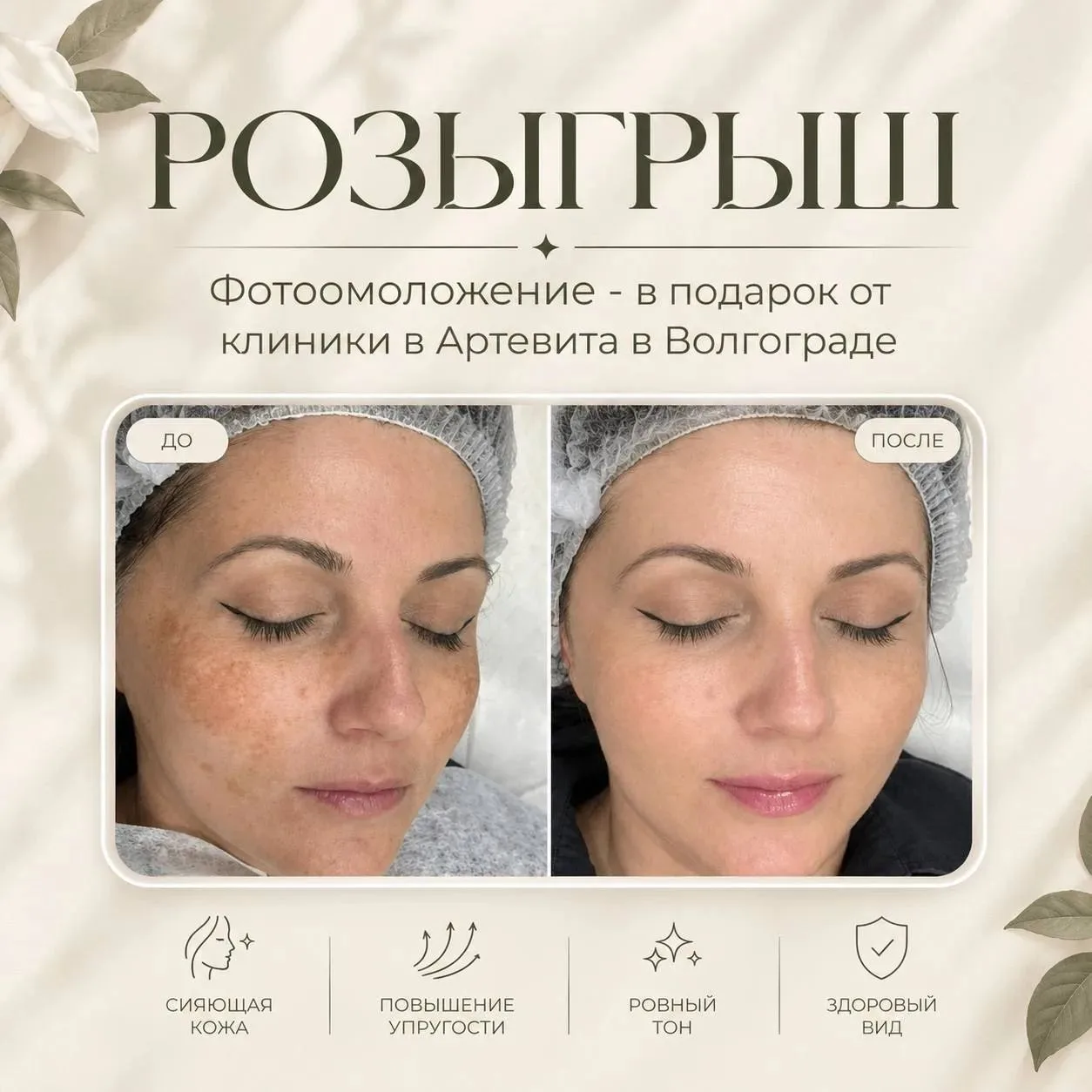 Волгоград, невероятный розыгрыш фотоомоложения на аппарате Lumenis M22! 💋