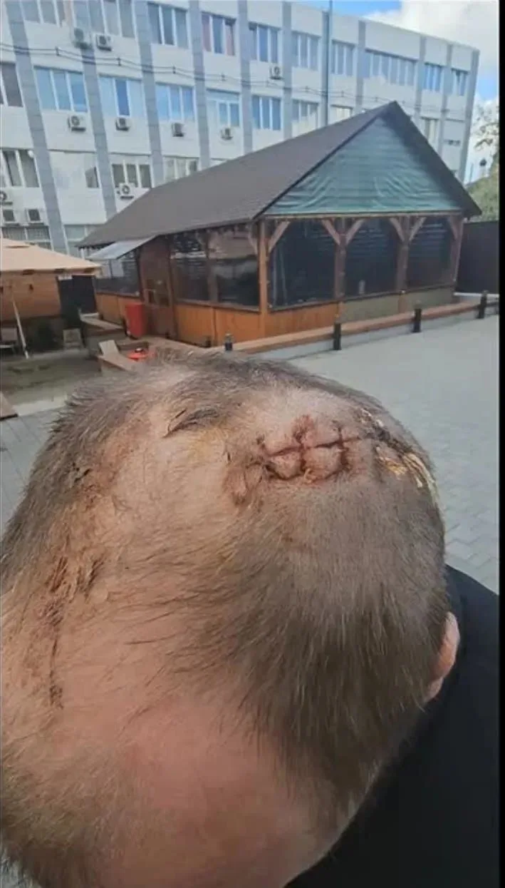 НАПАДЕНИЕ НА УЧАСТНИКА СВО в Товарково: СУД ВЫНЕС РЕШЕНИЕ.
