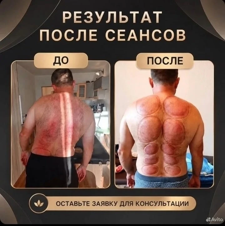 ✅ В ЗАВОДОУКОВСК приезжает лучший мануальный терапевт Тюмени!!!
