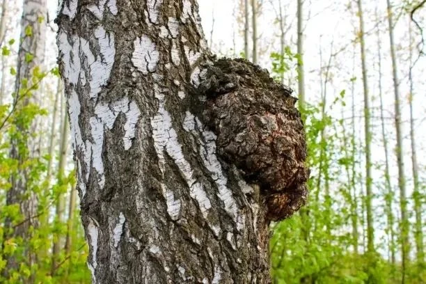 Сахарный диабет