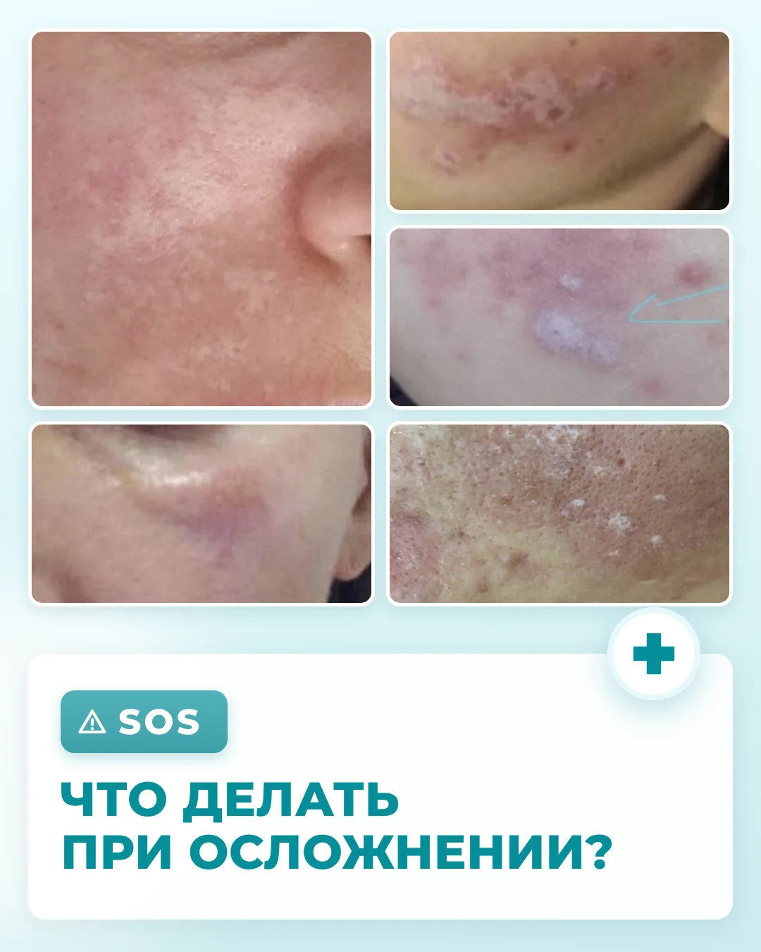 🆘 Реакция случилась: что делать – и чего категорически нельзя
