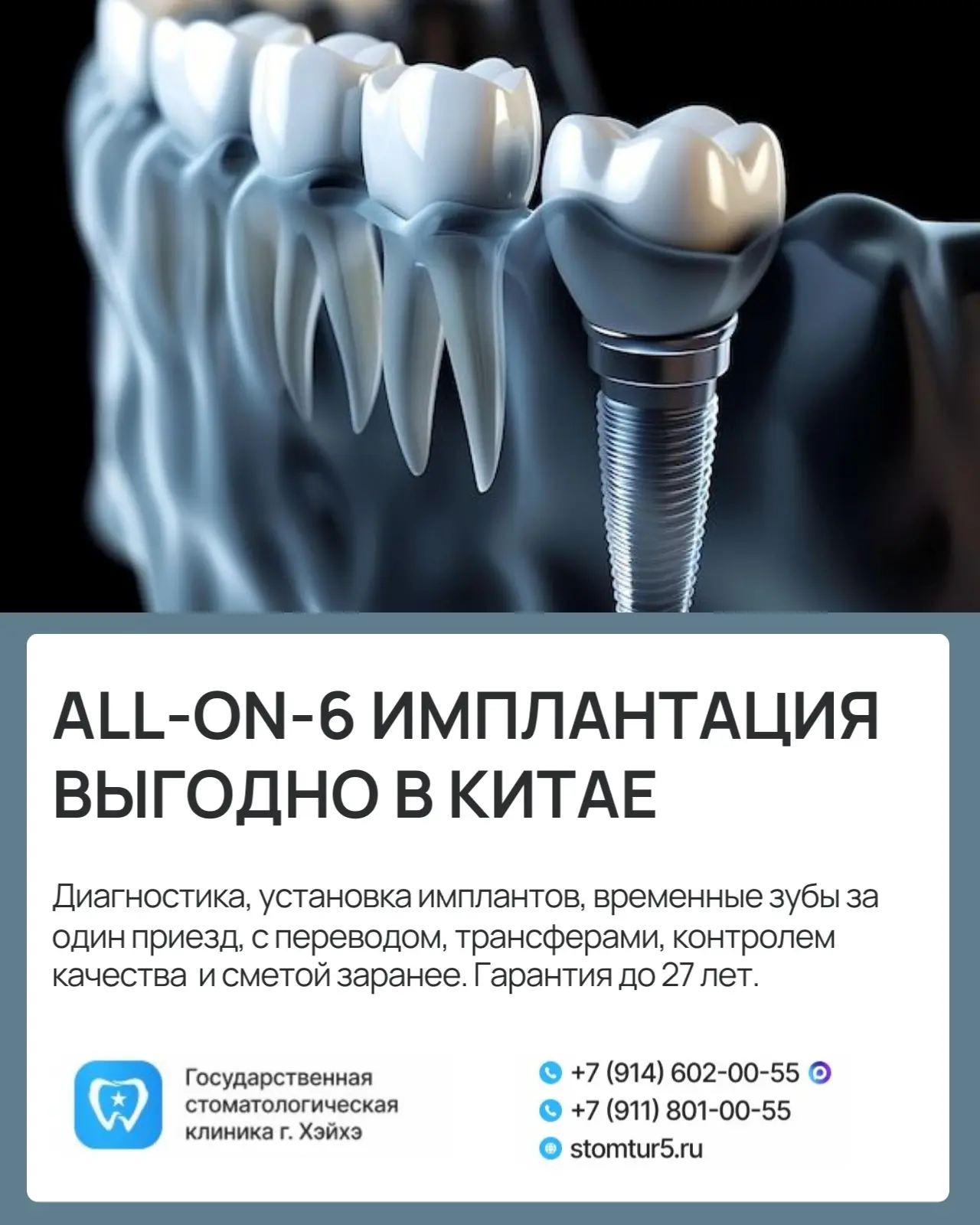Импланты мировых брендов: Straumann (Швейцария), Nobel Biocare (Швейцария-США), Dio Imp...