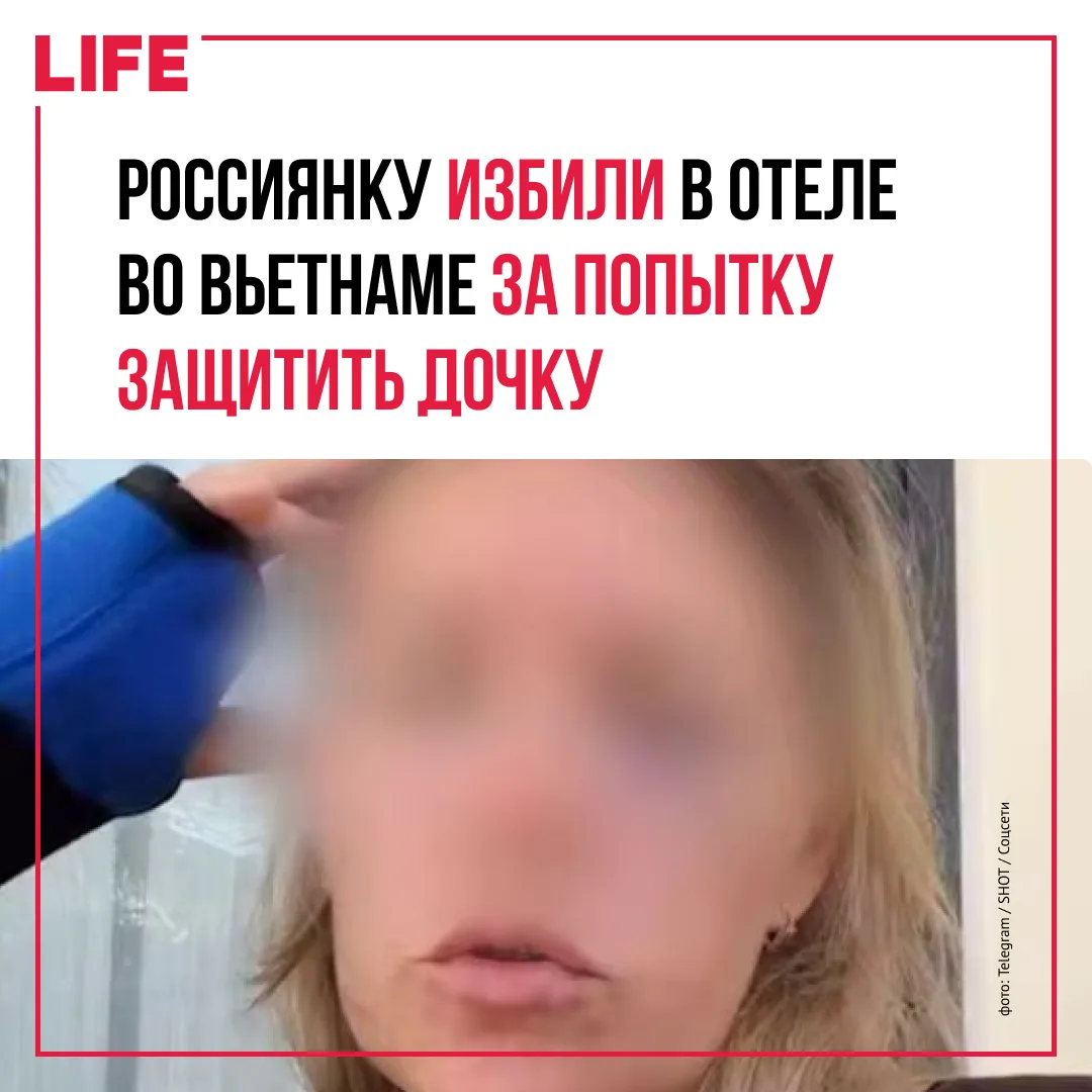 Российская туристка подверглась нападению во время отдыха с дочерью в отеле Selectum No...