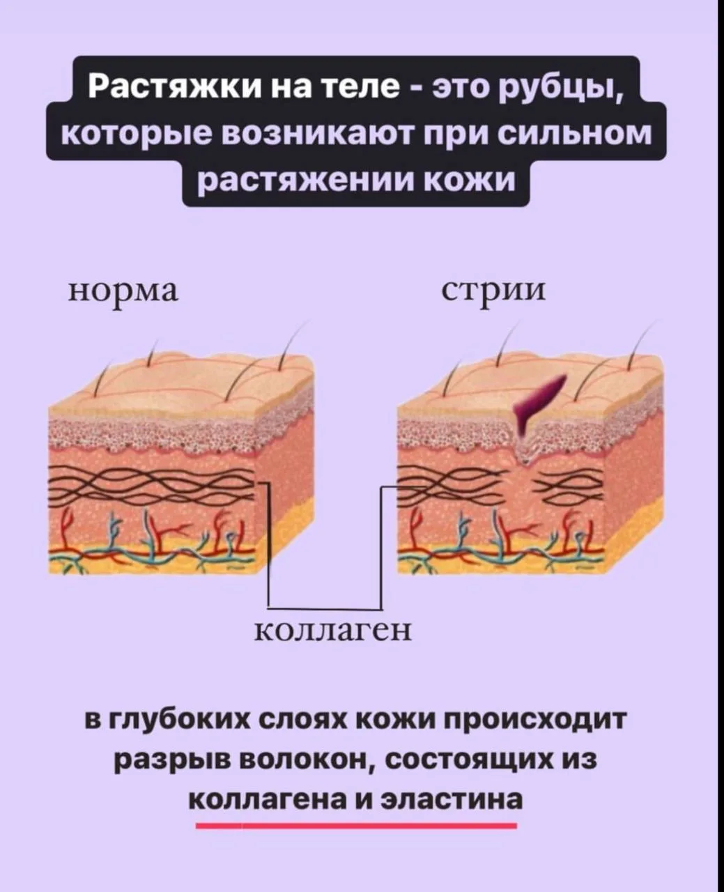 Поэтому важен состав того продукта, который вы используете!