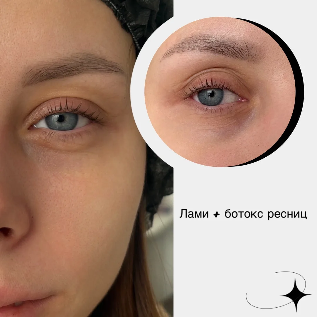 ✨ ТРЕБУЮТСЯ МОДЕЛИ НА ЛАМИНИРОВАНИЕ РЕСНИЦ ✨