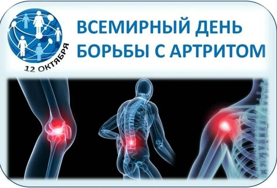 ✅ 12 октября - Всемирный день борьбы с артритом