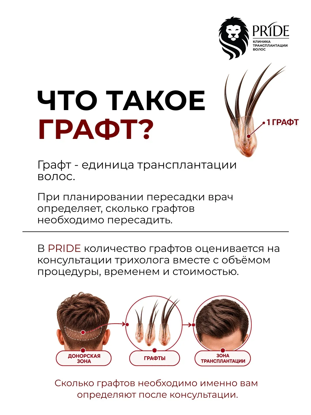 📩 Записаться на консультацию по трансплантации волос можно по ссылке в шапке профиля, ...
