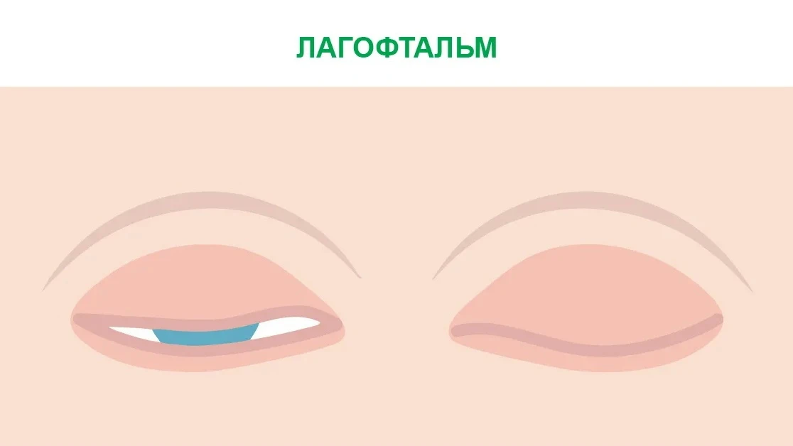 Молод, свеж и никогда не спишь🫠