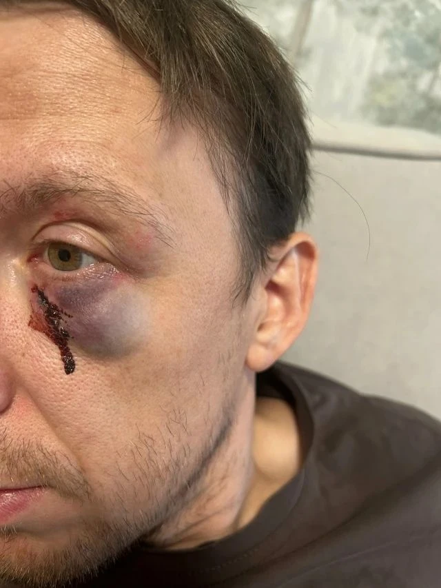 Анонимно.