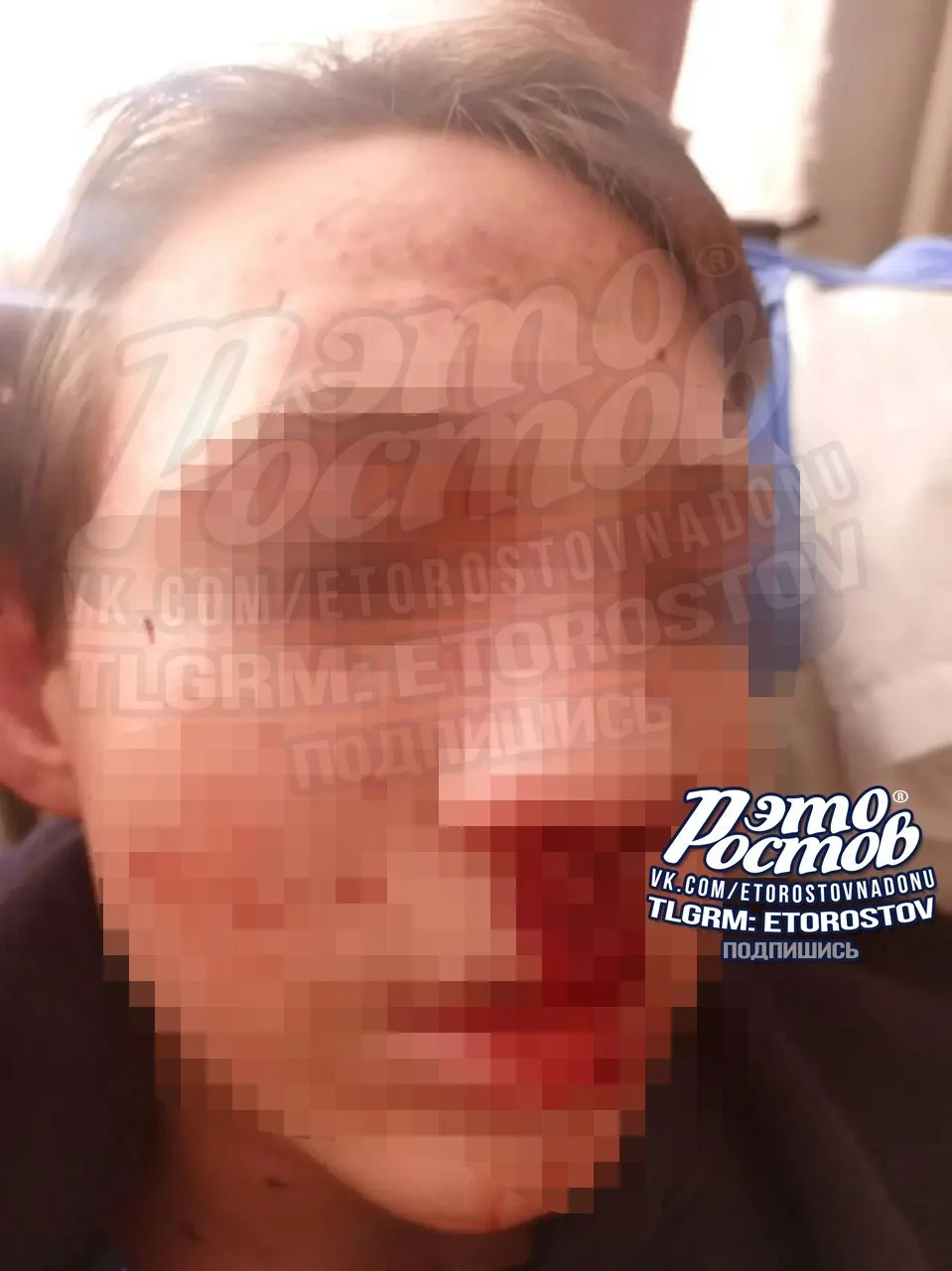 Родственник рассказал об избиении школьника