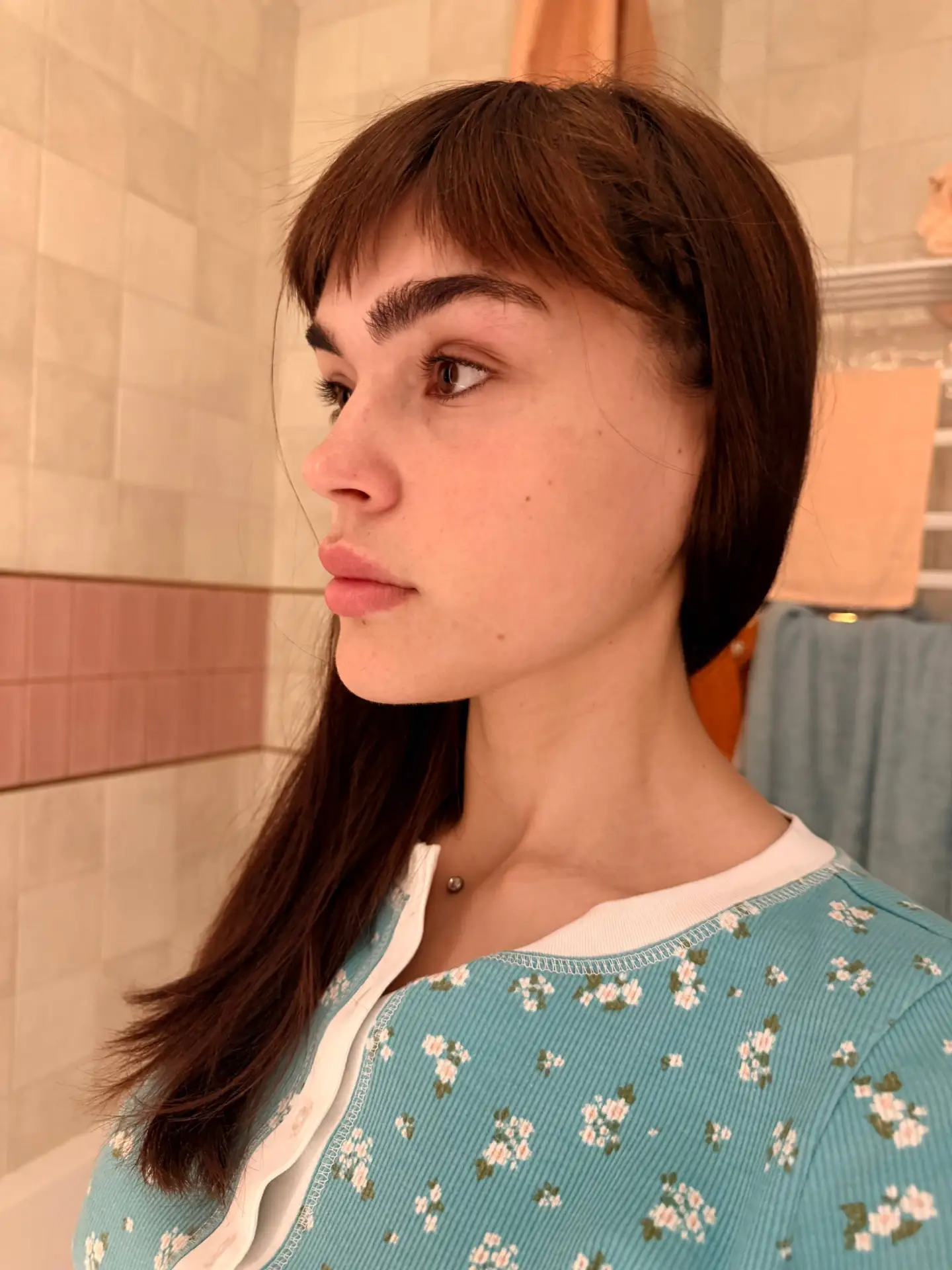 Кажется, прошёл ожог от ретинола.