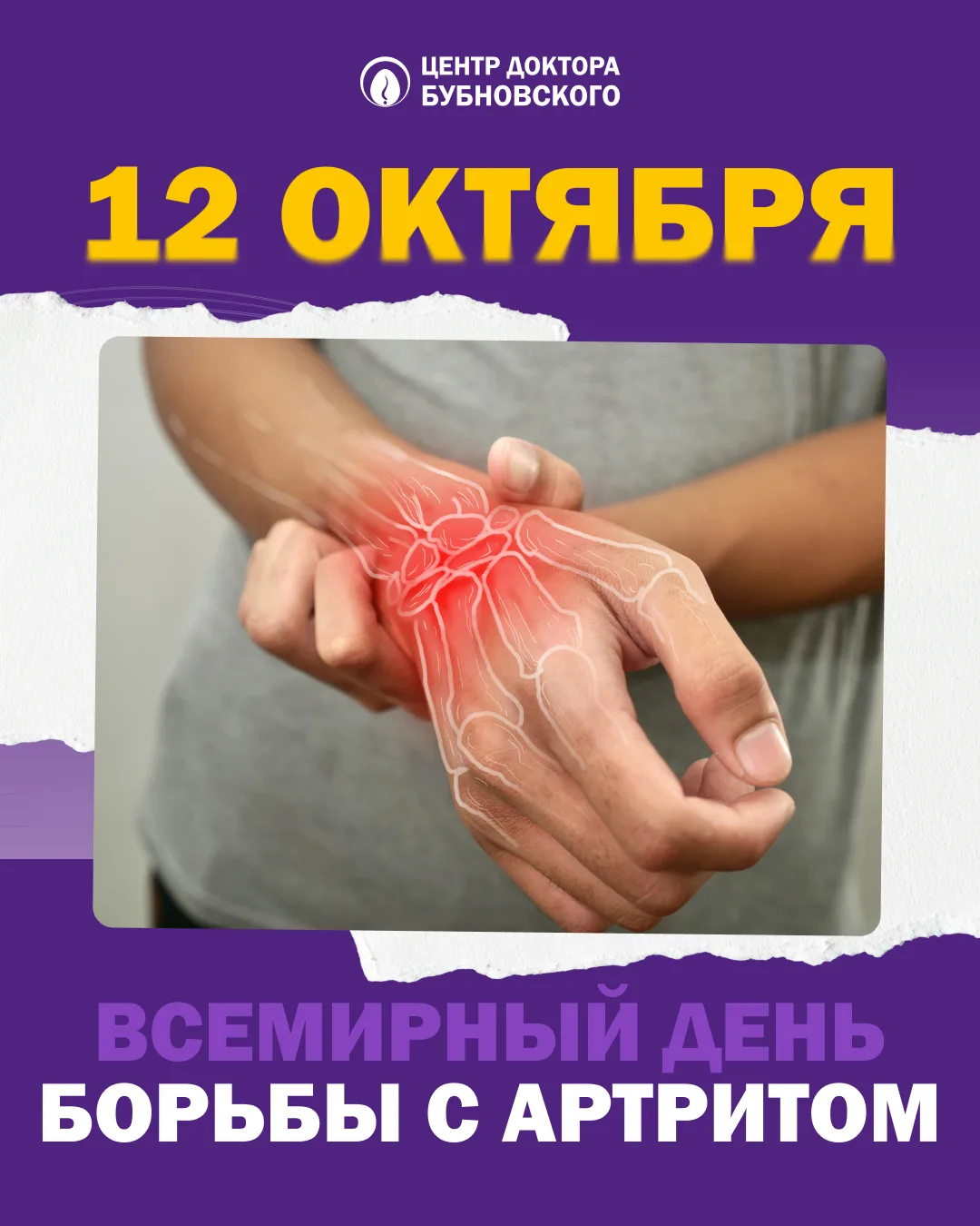 🦴 12 октября — Всемирный день борьбы с артритом