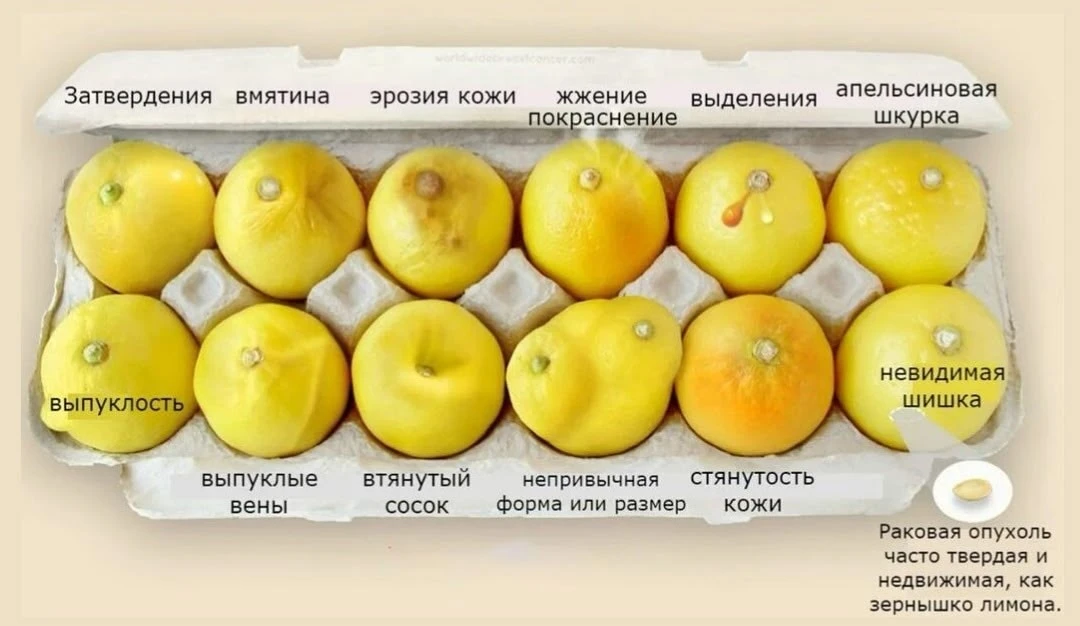 ❗Как может ощущаться рак молочной железы