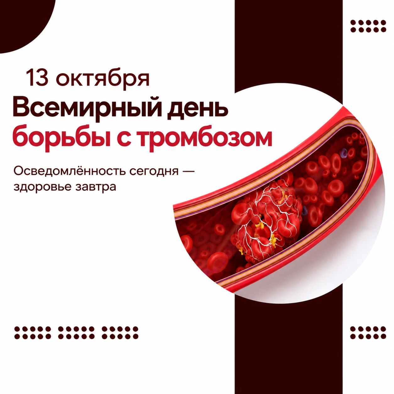 13 октября — Всемирный день борьбы с тромбозом